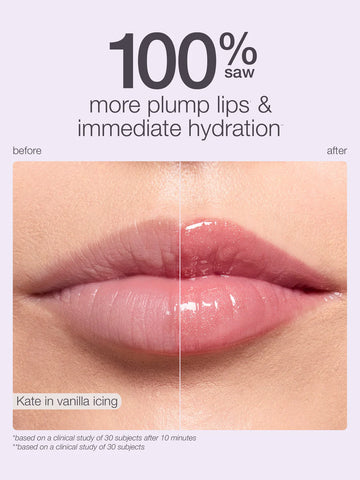 vanilla icing collection