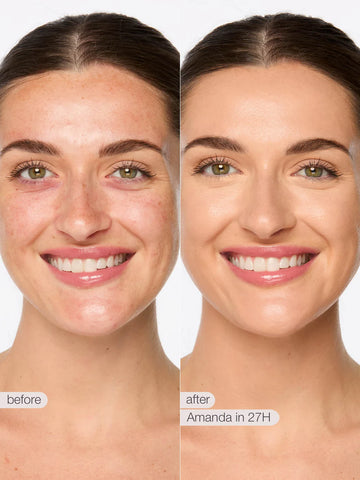 travel-size shape tape™ creamy concealer